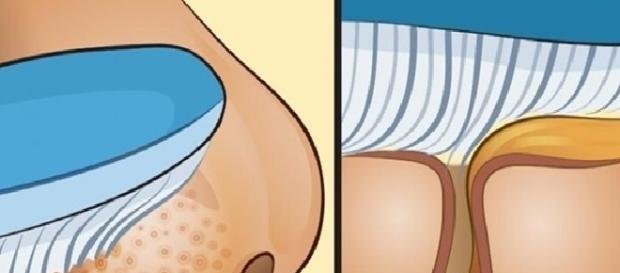 Técnica que utiliza escova remove todos os cravos em uma única aplicação Técnica que utiliza escova remove todos os cravos em uma única aplicação