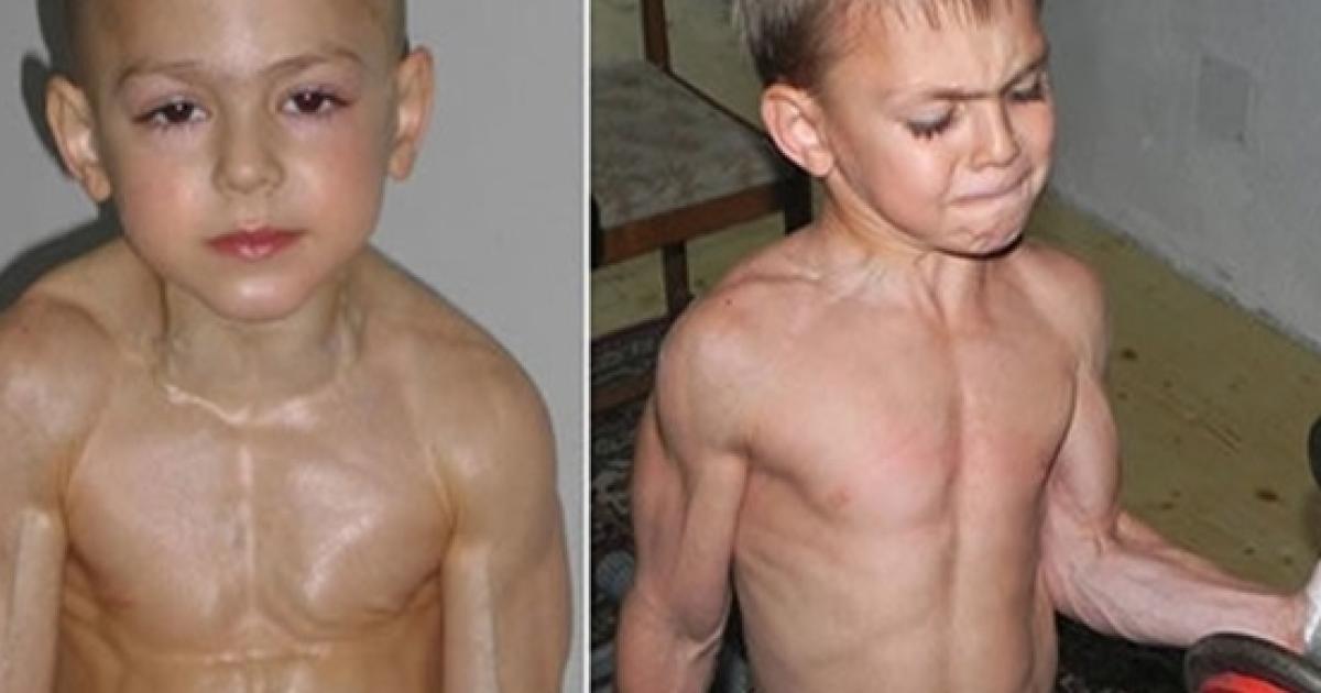 Veja como está hoje em dia