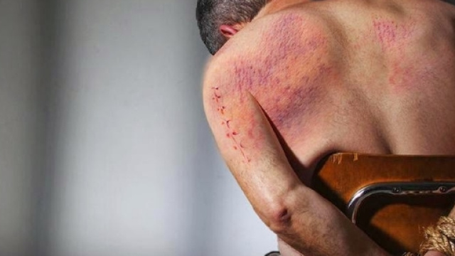 Cecenia, omosessuali torturati ad Argun