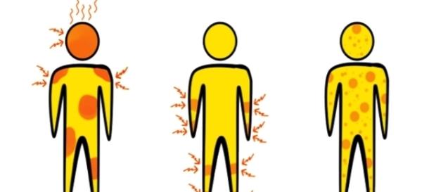 Conheças os sintomas da Dengue, Zika e Chikungunya Conheças os sintomas da Dengue, Zika e Chikungunya