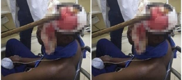 Homem é vitima de tentativa de assassinato Homem é vitima de tentativa de assassinato