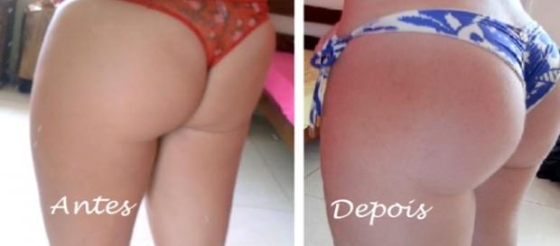 Imagem do bumbum, antes e depois dos exercícios. Imagem do bumbum, antes e depois dos exercícios.