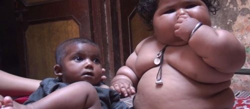 India, obesa di otto mesi pesa come un bimbo di quattro anni