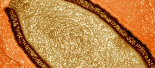 ACHAMAN GUAÑOC: Un virus gigante 'revive' tras pasar 30.000 años ... - blogspot.com