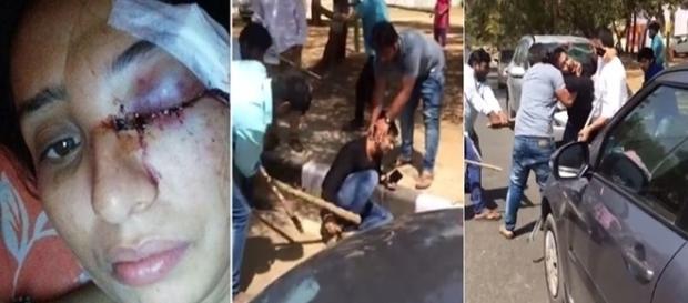 Nas imagens é possível ver a mulher com o rosto todo machucado e o momento em que o homem é agredido. Nas imagens é possível ver a mulher com o rosto todo machucado e o momento em que o homem é agredido.