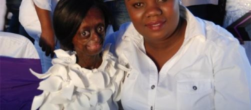 Ontlametse: una storia di vita drammatica