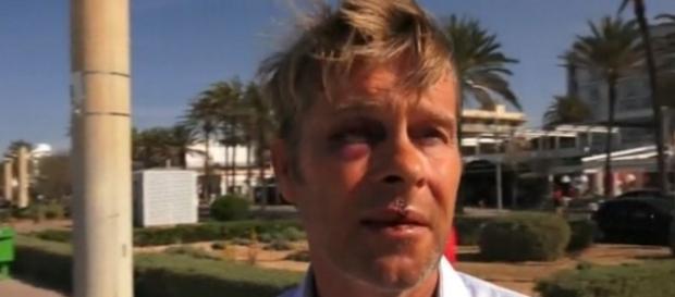 Hinnerk Baumgarten (49) ist von Wunden gezeichnet / Foto: Screenshot spot on news Hinnerk Baumgarten (49) ist von Wunden gezeichnet / Foto: Screenshot spot on news