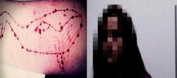 Mãe salva a filha de 15 anos de tentativa de suicídio Mãe salva a filha de 15 anos de tentativa de suicídio
