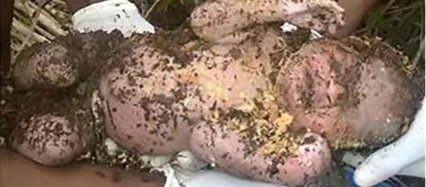 Bebê retirado dos escombros com vida Bebê retirado dos escombros com vida