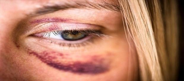 Mulher é vítima de agressão por parte do marido Mulher é vítima de agressão por parte do marido