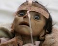Yémen, l'effroyable guerre oubliée du monde