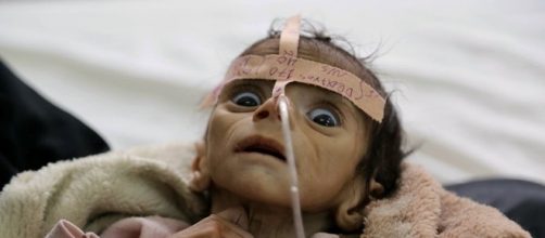 Yémen: un enfant mort de faim, symbole de l'indifférence générale - sputniknews.com