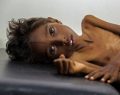 Famine : Vu l'absence de conscience que revêt leur existence, mort ou vif ...