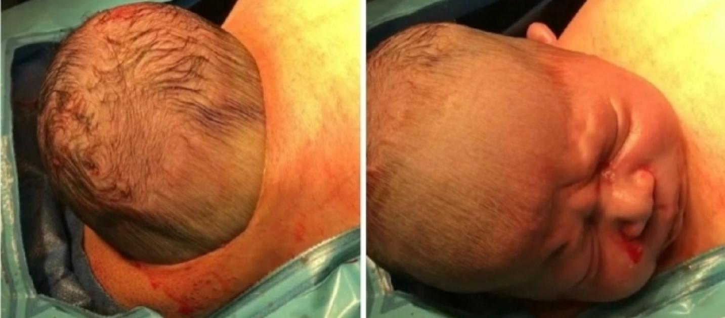 Imagens incríveis mostram a cabeça de um bebê saindo da barriga de sua mãe