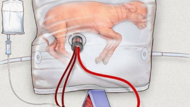 Des chercheurs cr&eacute;ent un ut&eacute;rus artificiel pour grands pr&eacute;matur&eacute;s ... - sciencesetavenir.fr