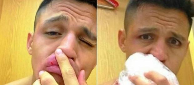 Arsenal news: Alexis Sanchez hits back after backlash from fans v ... - metro.co.uk Arsenal news: Alexis Sanchez hits back after backlash from fans v ... - metro.co.uk