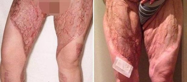 Imagens de como ficaram as pernas da mulher Imagens de como ficaram as pernas da mulher