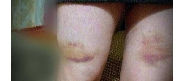 Denúncia feita por um homem identificado como Adam, que relata ter sofrido violências diarias Denúncia feita por um homem identificado como Adam, que relata ter sofrido violências diarias