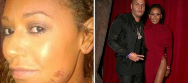 Mel B mostrando as marcas do casamento com Stephen Belafone Mel B mostrando as marcas do casamento com Stephen Belafone