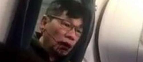 United passenger David Dao breaks silence, saying he's still in ... - scmp.com