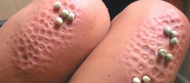 O medo de buracos conhecido como Tripofobia O medo de buracos conhecido como Tripofobia
