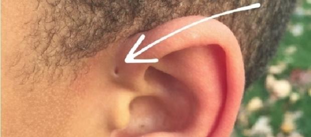 Este buraquinho não é uma marca de um piercing Este buraquinho não é uma marca de um piercing