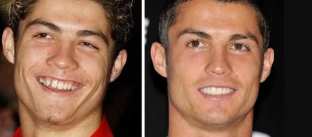 Cristiano Ronaldo e outras celebridades que mudaram com o tempo - Google Cristiano Ronaldo e outras celebridades que mudaram com o tempo - Google