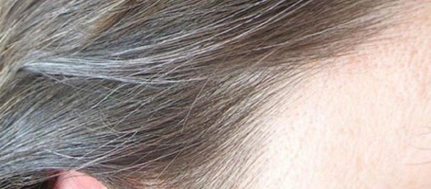 Scoperta la causa dei capelli bianchi e della calvizie Scoperta la causa dei capelli bianchi e della calvizie