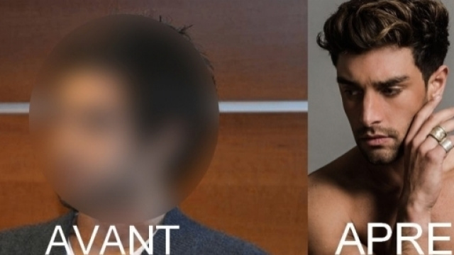 Valentin Leonard a particip&eacute; a L'amour est aveugle en 2011 et il n'&eacute;tait pas vraiment sexy...