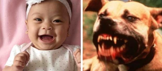 Bebê é vítima de pitbull - Imagem/Google Bebê é vítima de pitbull - Imagem/Google
