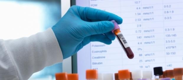 Hepatitis C infections tripled in five years | News OK - newsok.com Hepatitis C infections tripled in five years | News OK - newsok.com
