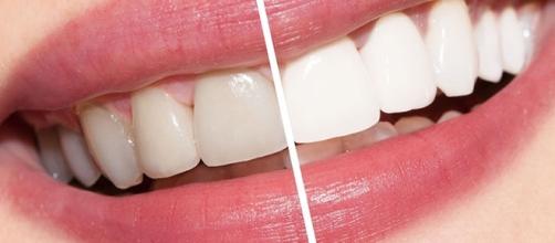É possível obter dentes mais brancos com produtos naturais
