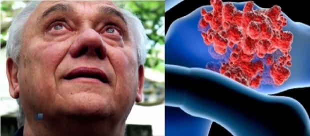 Marcelo Rezende descobre câncer de pâncreas, que atacou também o fígado Marcelo Rezende descobre câncer de pâncreas, que atacou também o fígado