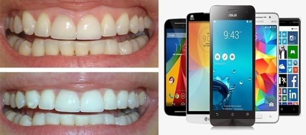 Luzes azuis do celular podem ajudar no clareamento dos dentes Luzes azuis do celular podem ajudar no clareamento dos dentes