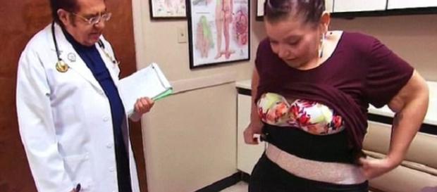 "My 600-lb Life" Dr. Now's gastric bypass surgery diet contradicts Weight Watchers. Source Youtube TLC "My 600-lb Life" Dr. Now's gastric bypass surgery diet contradicts Weight Watchers. Source Youtube TLC