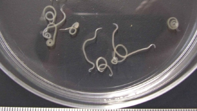 Sushi, anisakis: dov'è, come evitarlo | Velvet Body Italia - velvetbody.it