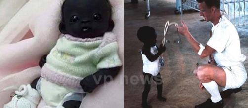 Supostas fotos de como era e como estaria o "bebê mais negro do mundo" (Foto: Montagem)