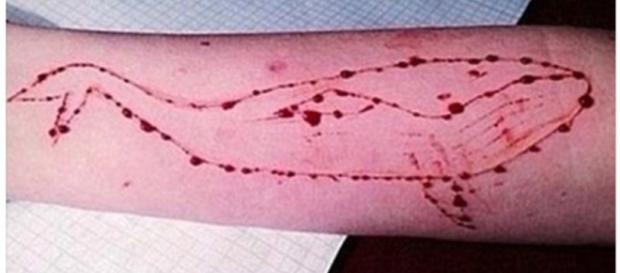 Il tatuaggio della Blue whale inciso sul braccio, 11ma regola del gioco Il tatuaggio della Blue whale inciso sul braccio, 11ma regola del gioco