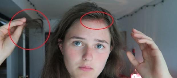 Sahara Brouwer, além de não lavar os cabelos por dois anos, ficou sem tomar banho por quase um mês Sahara Brouwer, além de não lavar os cabelos por dois anos, ficou sem tomar banho por quase um mês