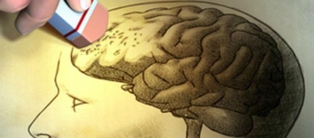 Alzheimer como superar essa doença (ilustração retirada do Google) Alzheimer como superar essa doença (ilustração retirada do Google)