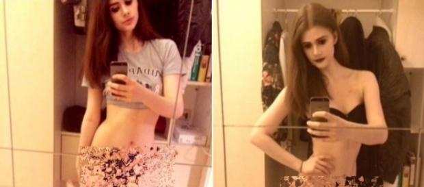 Jovem de 18 anos vai vendeu sua virgindade. ( Foto: Reprodução) Jovem de 18 anos vai vendeu sua virgindade. ( Foto: Reprodução)