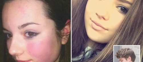 A sinistra il selfie che Emily Drouet ,18 anni, percossa dal fidanzato (a destra) si è fatta prima di uccidersi.