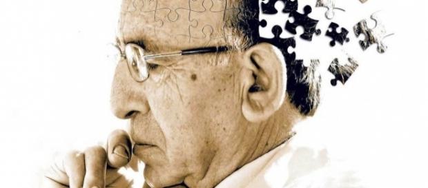 Dementia and Alzheimer's disease overtake heart disease as the ... - planetfreewill.com Dementia and Alzheimer's disease overtake heart disease as the ... - planetfreewill.com