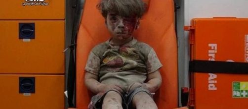 Siria, Aleppo: bambino ferito nei bombardamenti | Foto e Video - today.it