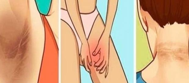 De acordo com dermatologista, esse tratamento natural é muito eficiente De acordo com dermatologista, esse tratamento natural é muito eficiente