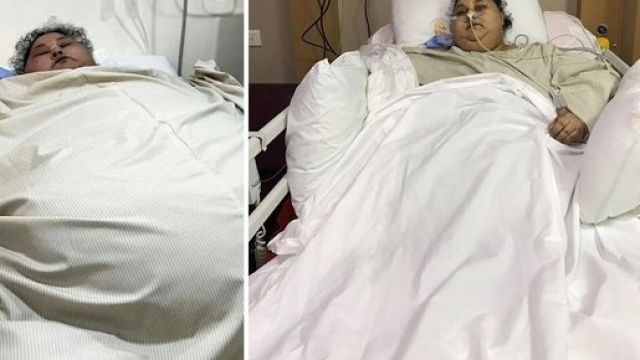 Un lento percorso verso la 'normalit&agrave;', Emam non &egrave; pi&ugrave; la donna pi&ugrave; grassa del mondo, ha perso 300 chili in India. Foto: arabnews.com.