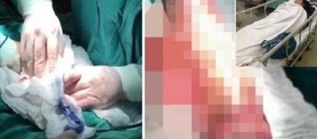 Mulher brinca com mandioca e se da mal Mulher brinca com mandioca e se da mal