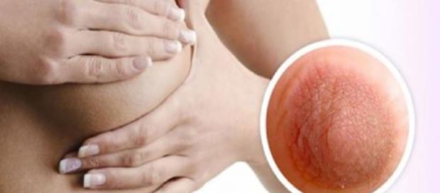 Ciência fala de sintomas de doença - Imagem/Google Ciência fala de sintomas de doença - Imagem/Google