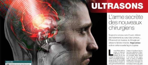 Ultrasons : l'arme secrète des nouveaux chirurgiens - Science-et ... - science-et-vie.com Ultrasons : l'arme secrète des nouveaux chirurgiens - Science-et ... - science-et-vie.com