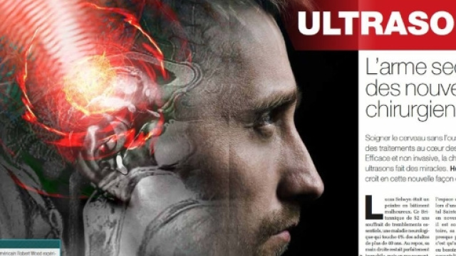 Ultrasons : l'arme secrète des nouveaux chirurgiens - Science-et ... - science-et-vie.com